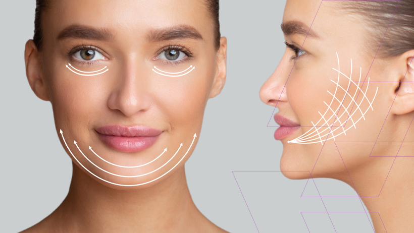 Masseter Botoks ile Çene Hattınızı Şekillendirin